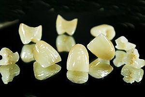 All-ceramic zirconia